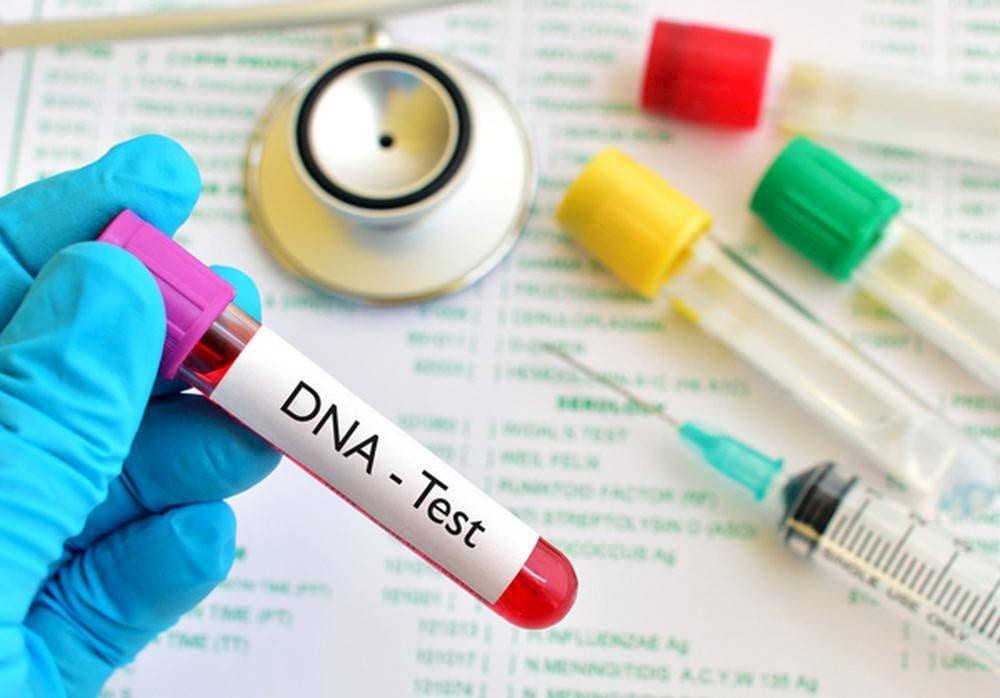 Cần chuẩn bị những gì trước khi xét nghiệm ADN
