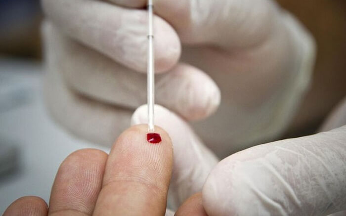 Lấy máu tươi cũng là một cách lấy mẫu thử để xét nghiệm ADN tốt nhất