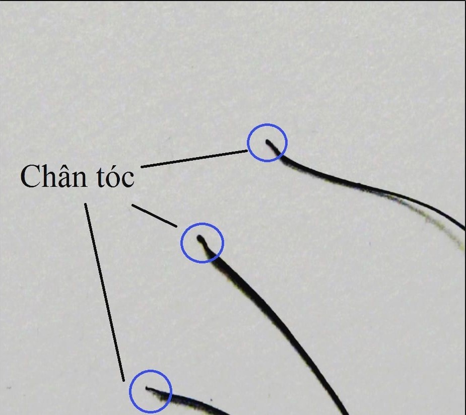 Mẫu tóc thử ADN 