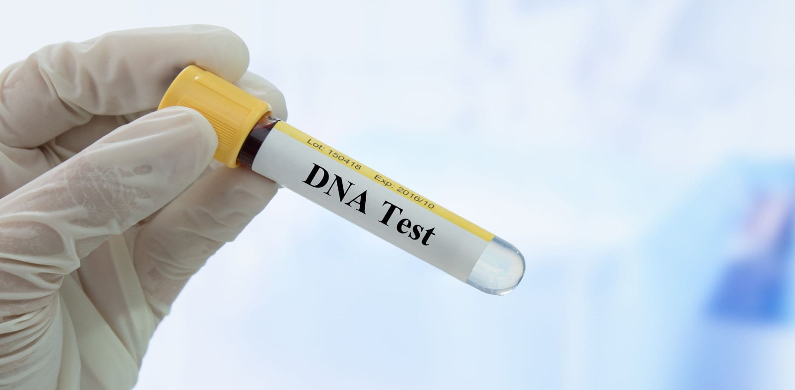 Kiểm tra huyết thống gồm có hai loại hình cơ bản xét nghiệm ADN tự nguyện và xét nghiệm ADN pháp lý
