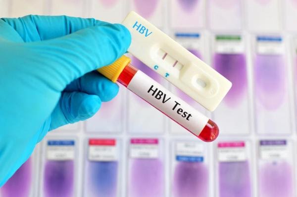 Xét nghiệm định lượng HBV DNA sẽ có giá 600.000 VND
