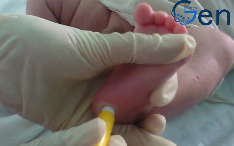 Thu mẫu máu của trẻ sơ sinh
