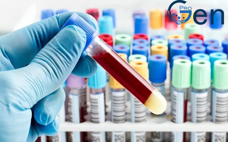 Sử dụng mẫu máu để xét nghiệm ADN pháp lý