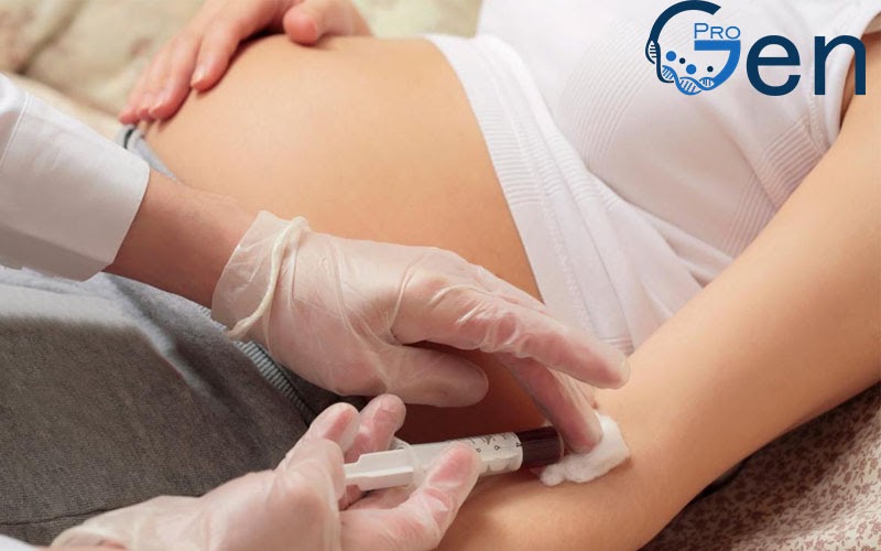 Xét nghiệm ADN sàng lọc trước sinh sử dụng máu thai phụ để phân tích