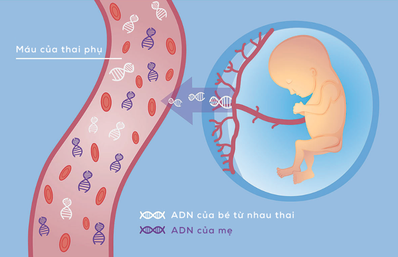 Xét nghiệm không xâm lấn NIPT tuy an toàn nhưng mắc tiền hơn so với chọc ối
