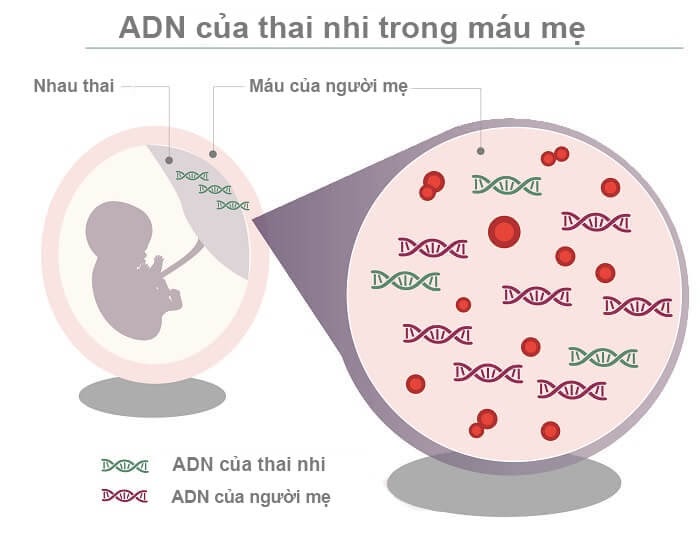 Xét nghiệm ADN thai nhi không xâm lấn an toàn tuyệt đối 
