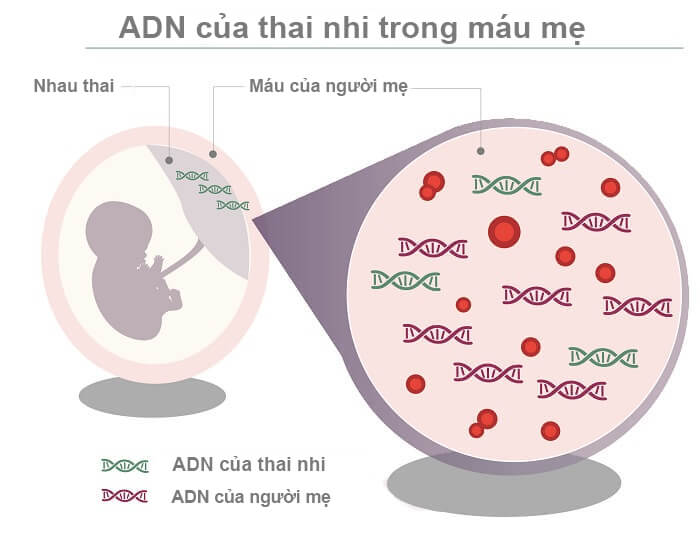 Tại sao nên thực hiện xét nghiệm ADN trước khi sinh?